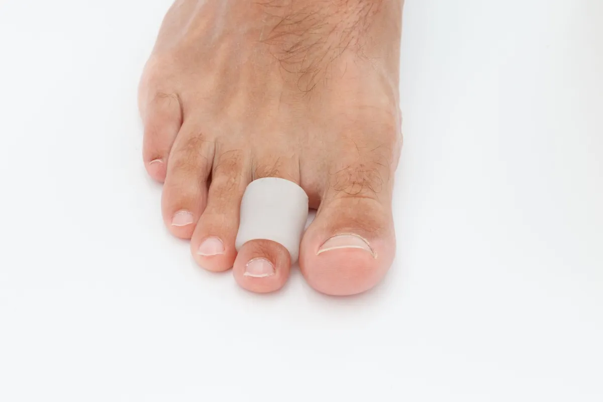 tratament deget ciocan la picior Degetul ciocan: cauze frecvente și opțiuni de tratament eficiente