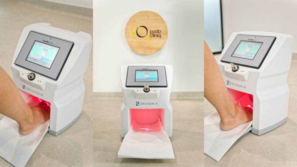  Tratament onicomicoza (ciuperca unghiei) cu laser Lunula, igienizări, terapii topice | PodoCliniq